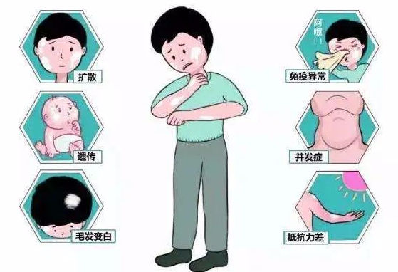哪些因素会让白斑难以治疗？(图1)